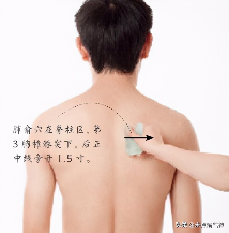 湿气重咽炎怎么治,湿气重得了慢性咽炎要怎么治疗