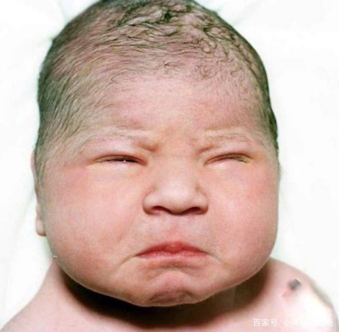 新生儿入睡困难最好的治疗方法,新生儿宝宝入睡困难的解决方法