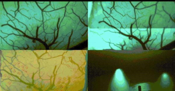 未来马斯克最新机器人,马斯克宣布脑机接口患者恢复