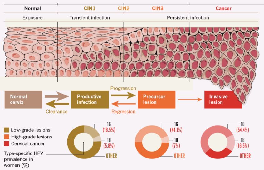 宫颈癌最深度解读,宫颈癌筛查报告正确解读