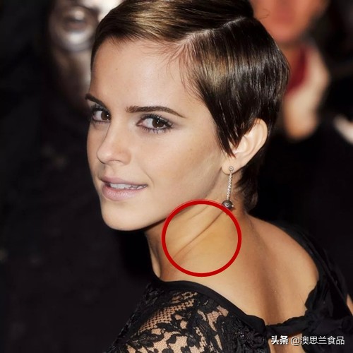 一招教你淡化颈纹,懒人最简单快速的去颈纹方法