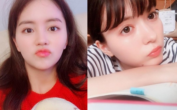 嘴唇干裂的护唇方法,冬季如何防止嘴唇干裂出血