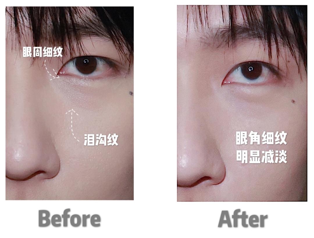 张大奕早期瑞丽照片,张大奕瑞丽