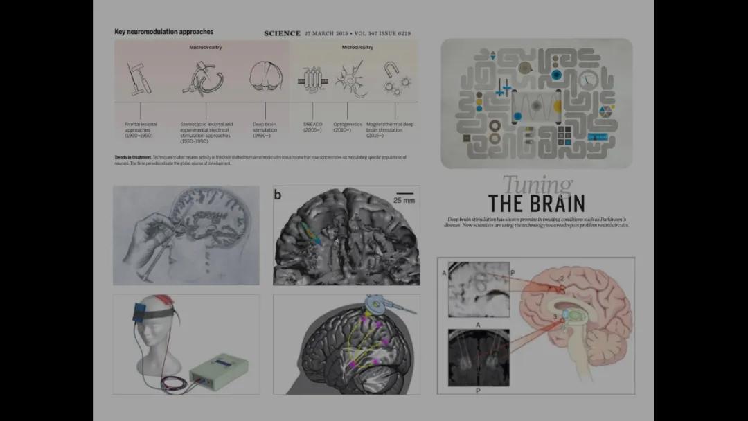 五个能控制你大脑的可怕实验,电击治疗精神分裂症会失忆吗