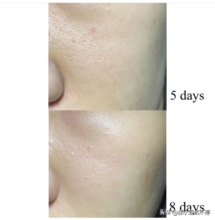 日本三大化妆水排名,日本人最爱用的保湿水