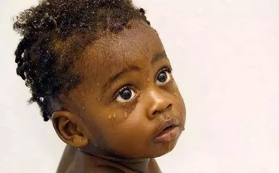 和艾滋病人无保护接触传染概率,艾滋病人日常生活接触会被传染吗