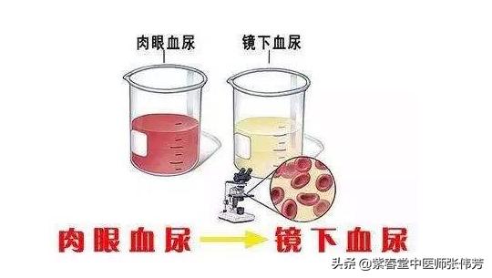 小孩过敏性紫癜要吃多久的中药好,孩子过敏性紫癜吃什么中药