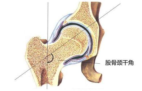 小腿外翻如何纠正和站立,小腿外翻如何调整