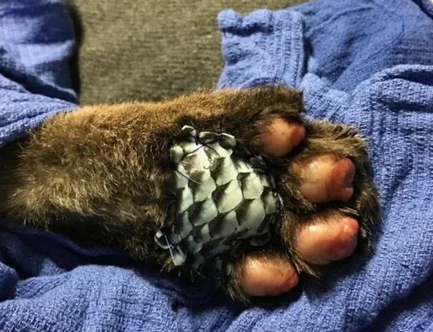 罗非鱼鱼皮治疗烧伤后价值,用罗非鱼鱼皮治疗烧伤