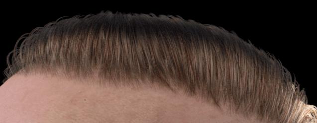 3d防脱发动画,毛发生长3d动画