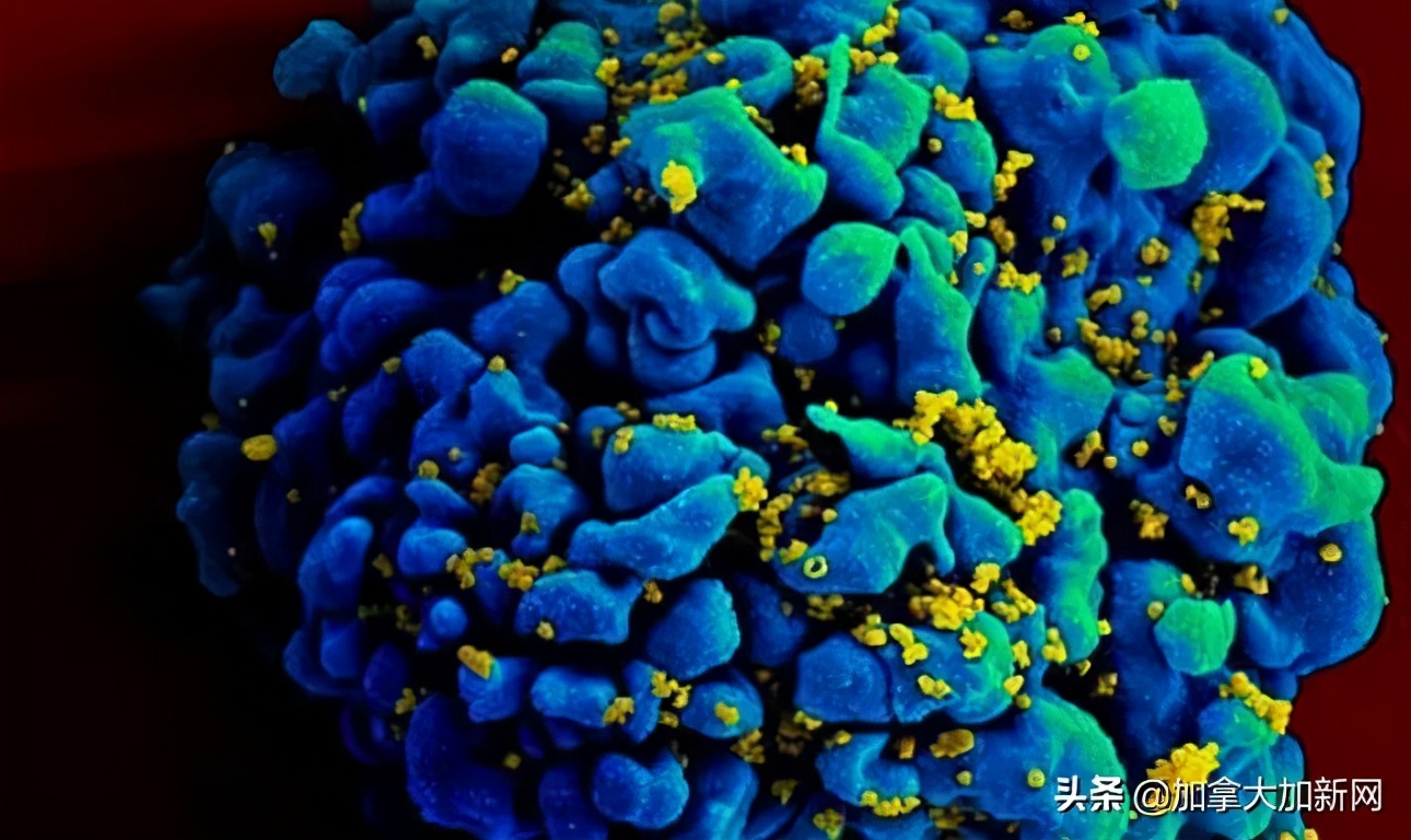 南美洲最近新型病毒,新冠疫情南美死亡多少人