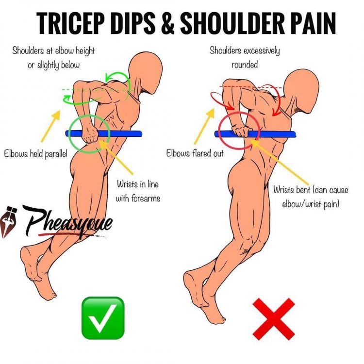撸铁时关节响是什么原因,健身肩膀关节咔咔响还能继续练