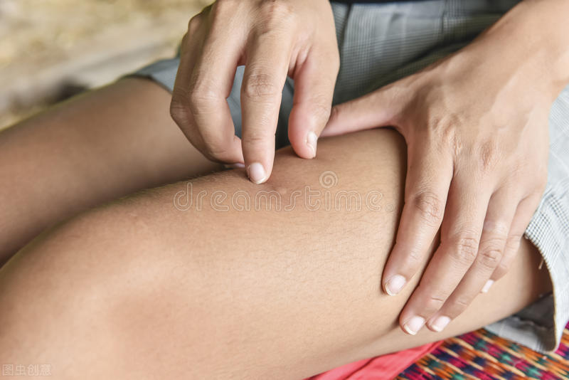 虫咬性皮炎高发医生支招来防范,虫咬性皮炎预防妙招