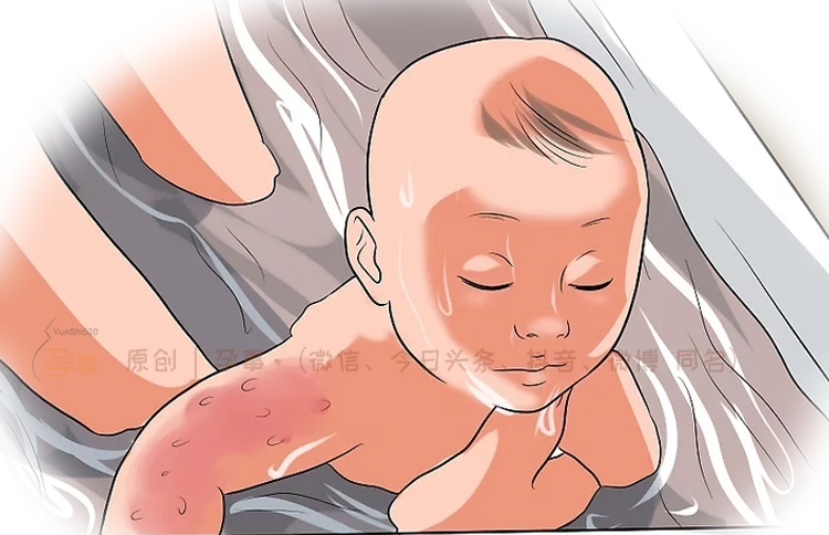 宝宝夏天起痱子最有效的解决方法,宝宝长了痱子用什么方法最有效