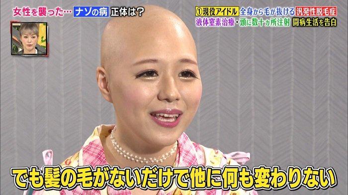 日本15岁脱毛症状,日本脱毛症