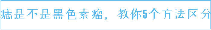 痣的颜色深浅不一是不是黑色素瘤,痣长在哪容易变成黑色素瘤