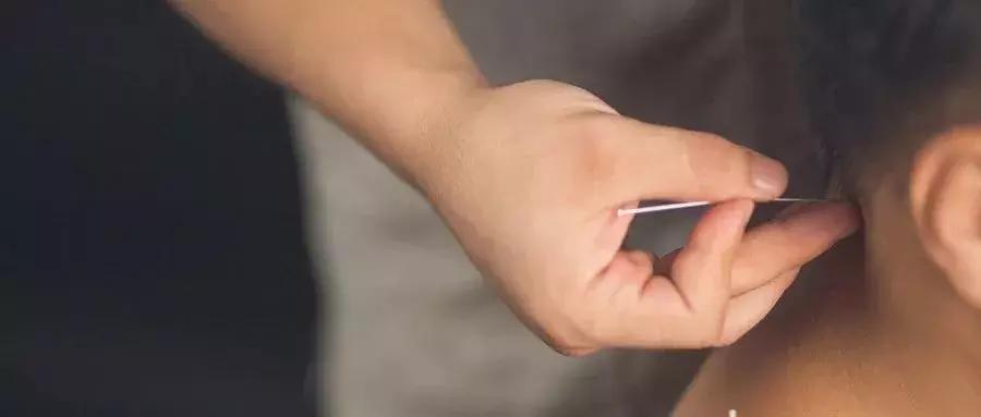 中医针灸基础知识入门教程,中医针灸入门全套视频