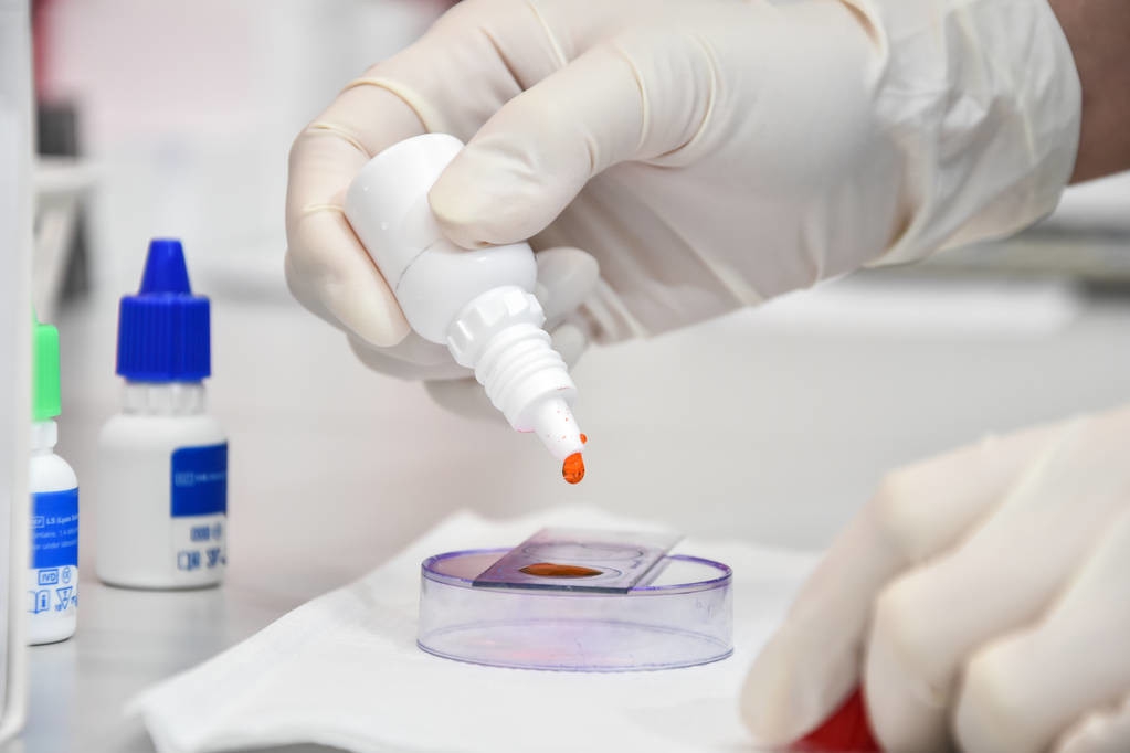 精子不液化咋办,精子不液化该怎么办