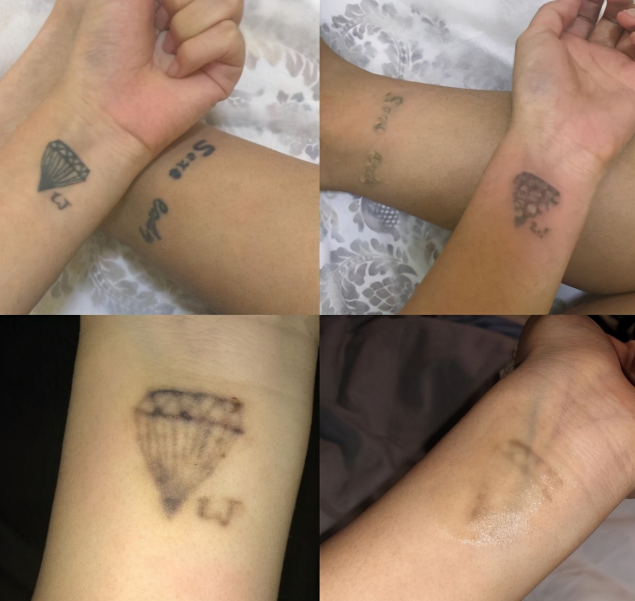 自己洗纹身最好的方法不留疤,洗纹身最好的方法不留疤多少钱