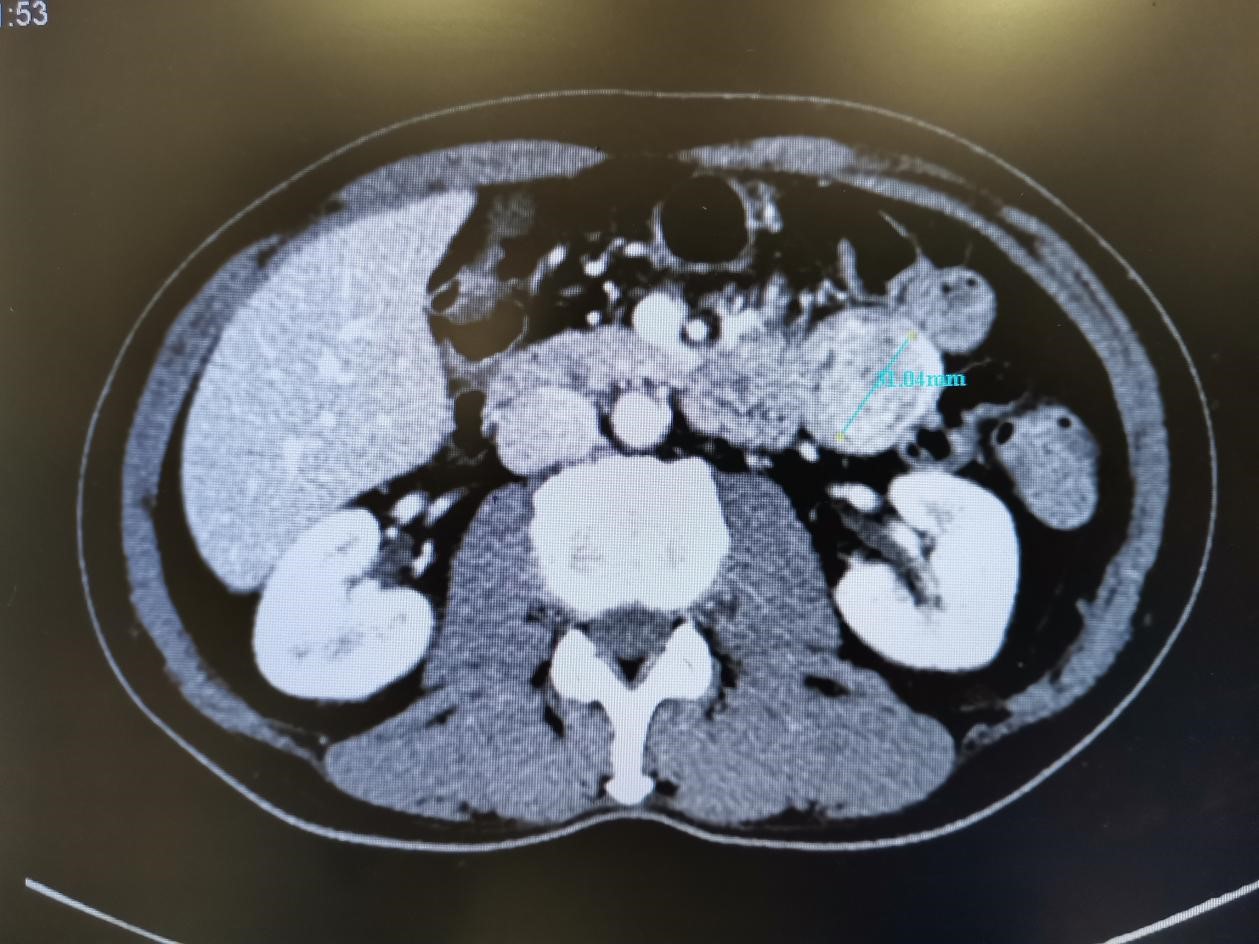 狡猾的它不是癌，却胜似癌