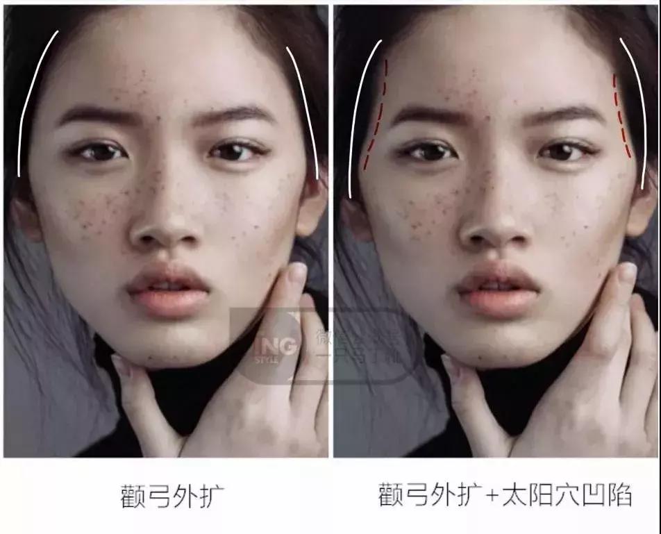 俞飞鸿颧骨抗老,高颧骨俞飞鸿