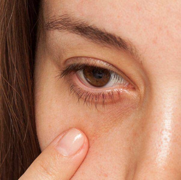 眼睛没有细纹需要眼膜吗,眼膜有用吗能去皱纹吗