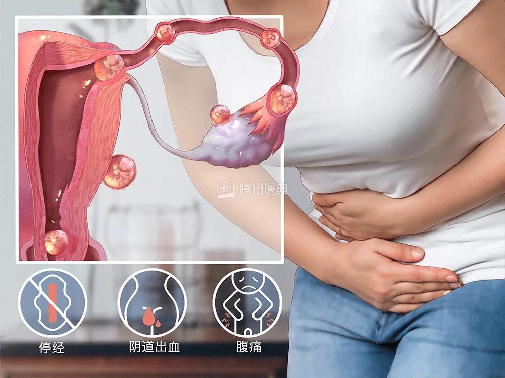 月经没来小肚子隐隐作痛怎么回事,小肚子疼但是没来月经会是怀孕吗