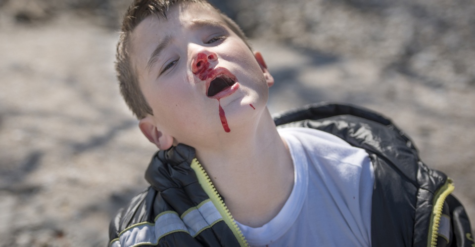 流鼻血的恐怖现象,流鼻血有多恐怖