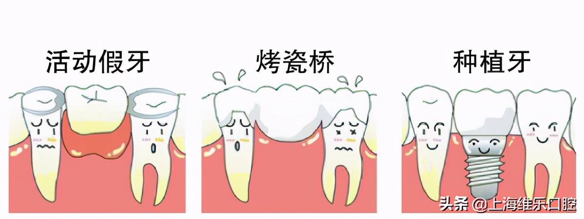 戴假牙引起的牙龈增生如何处理,戴假牙牙龈肿痛怎么缓解