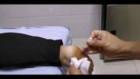 脚后跟骨刺痛是什么原因引起的,跟骨骨刺导致脚后跟疼