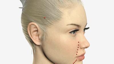 有法令纹特显老教你几招抚平细纹,法令纹这么显老得如何搞定