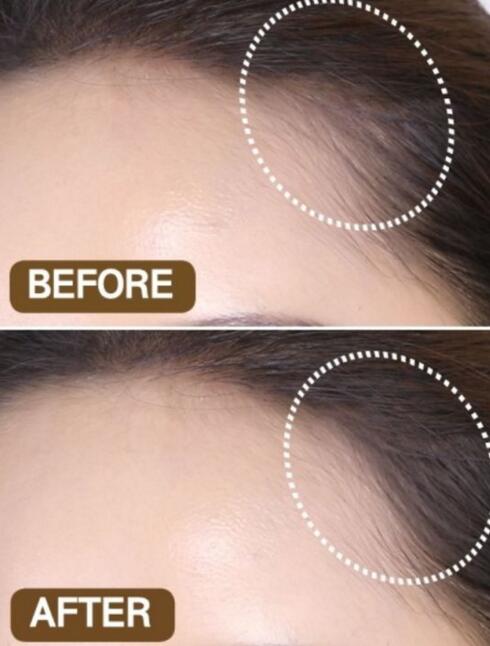 女生头发太贴头皮怎么处理,女生头发太少太软太贴头皮怎么办