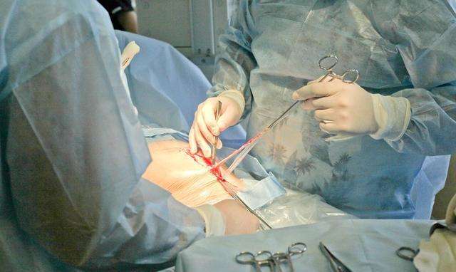 剖腹产是美容线好还是拆线的好？区别有4点，孕妇早知道早避免