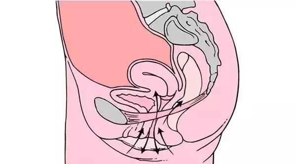 顺产时，自然撕裂、侧切哪个恢复快？有什么区别和影响？