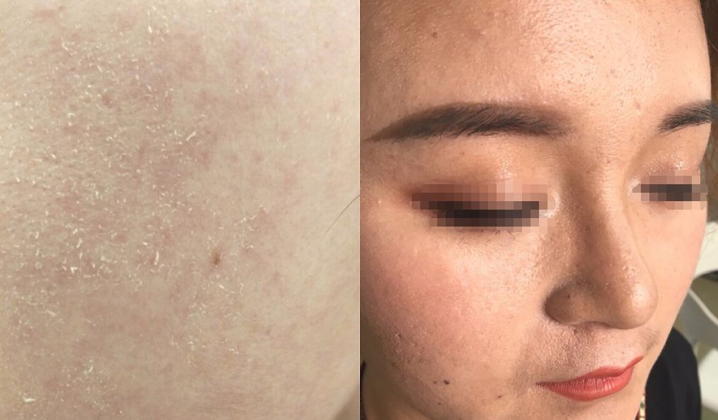 赵露思推荐补水保湿,赵露思推荐水感保湿焕颜面霜