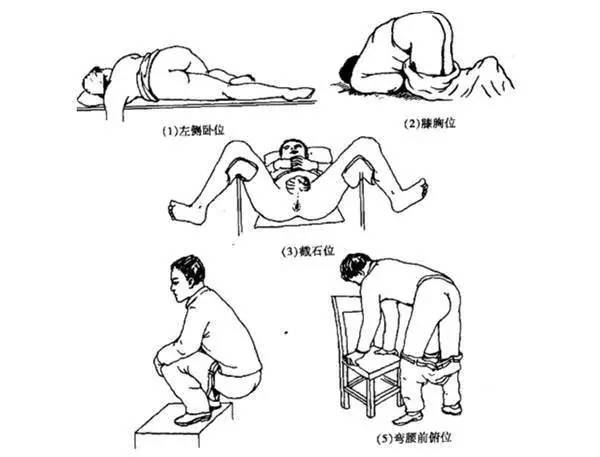 保留灌肠总结,灌肠术的操作反思