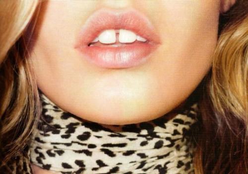 牙签清理牙缝会怎样,牙签剔牙齿容易出血怎么办