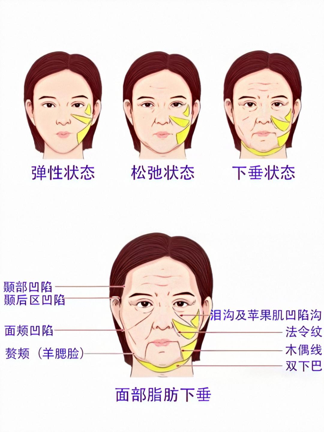 脸上皱纹多皮肤松弛怎么办问医生,皱纹多皮肤松弛做拉皮需要多少钱