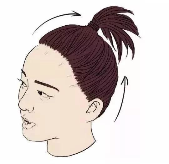 女性发际线后移是什么原因导致的,女人发际线越来越高意味着什么