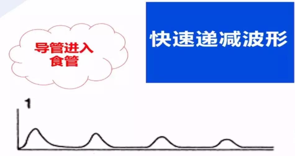 李娟教授：呼气末二氧化碳分压监测的临床应用