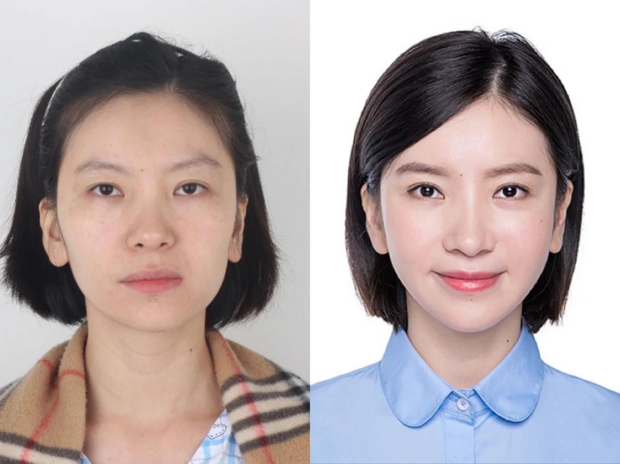 新氧公益与医美,新氧公益救助项目有哪些