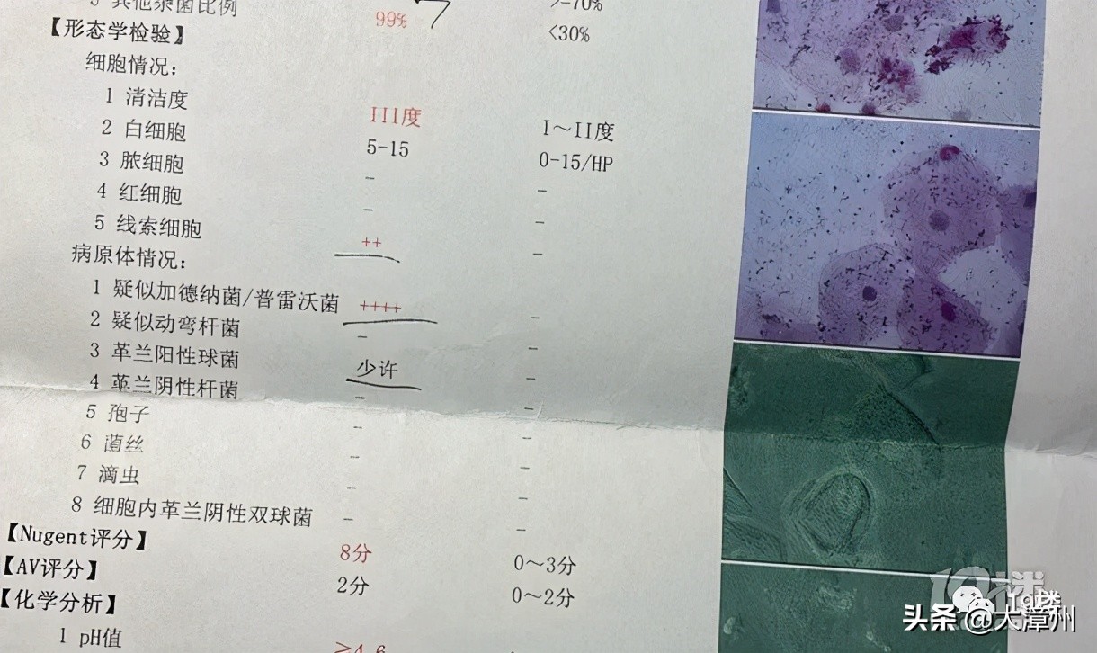 杭州姑娘为图方便，穿了半个月一次性*裤内**