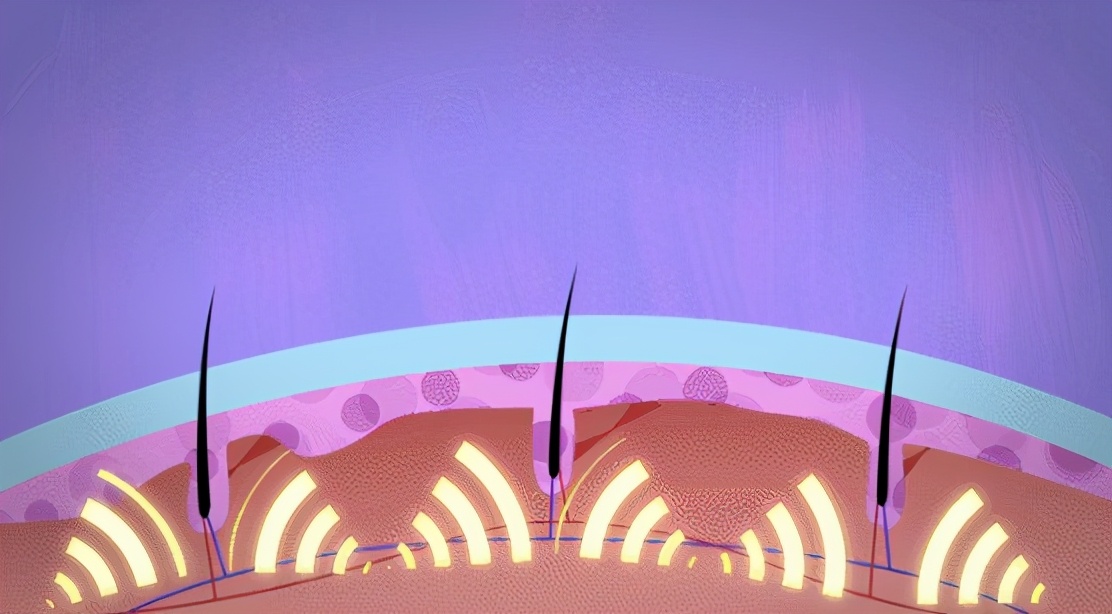 防脱洗发水真相大揭秘,话说防脱洗发水真的有用吗