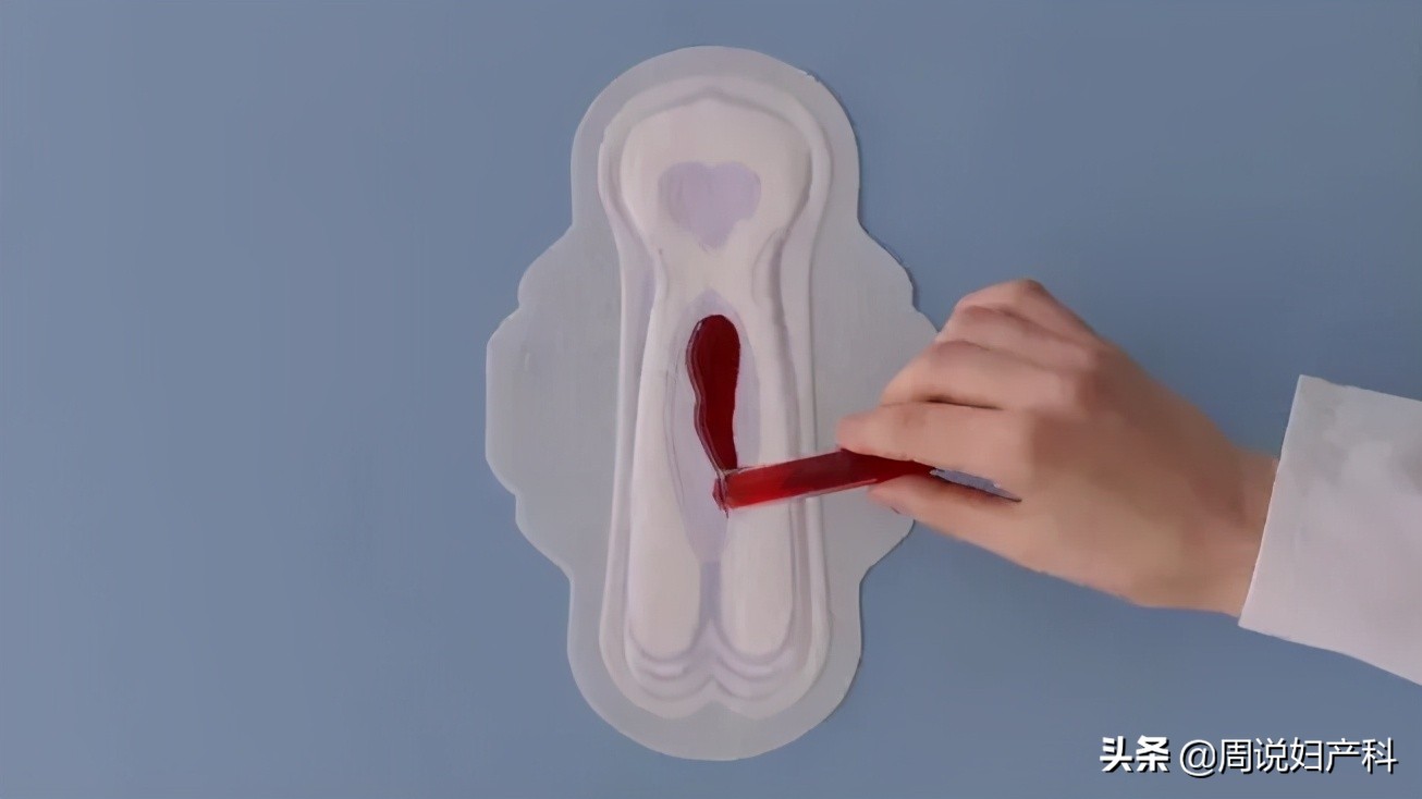 白带异常这些信号,越早了解,好得越快