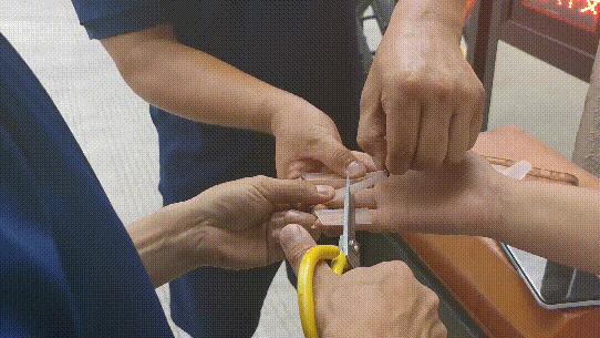 手指不小心被502胶水粘住了怎么办,手被502粘住求助消防员