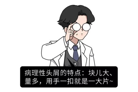 头发隔多久洗一次才好？不同发质要怎么洗？看完不再纠结