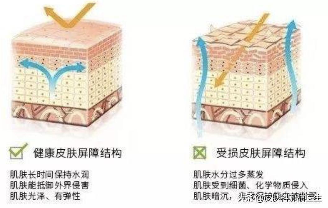脸部皮肤过敏期间怎么护肤,脸部过敏是护肤品还是食物导致的
