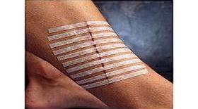 烧伤疤痕后遗症怎么治,烧伤愈合后疤痕处理案例