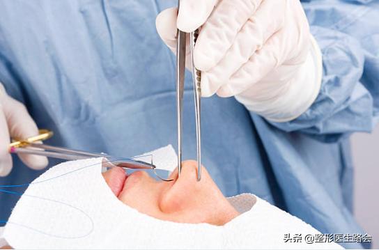 隆鼻膨体好还是玻尿酸好,硅胶膨体和玻尿酸隆鼻