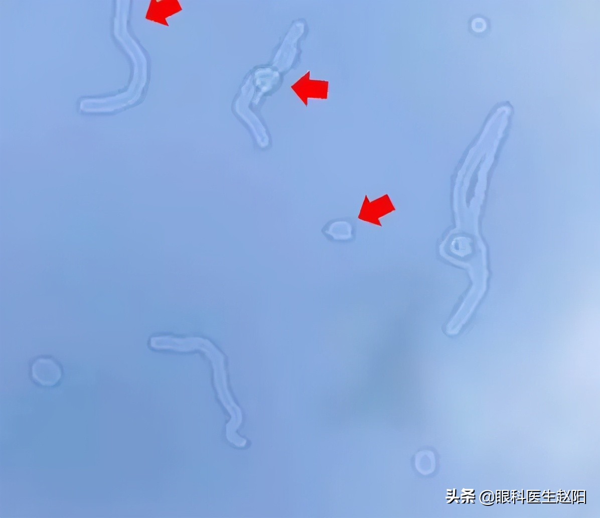 红光治疗仪使用注意事项！近视防控纯干货分享